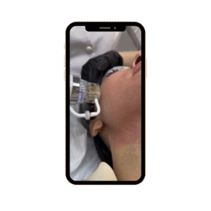 חבילת REELS מיקרושיידינג